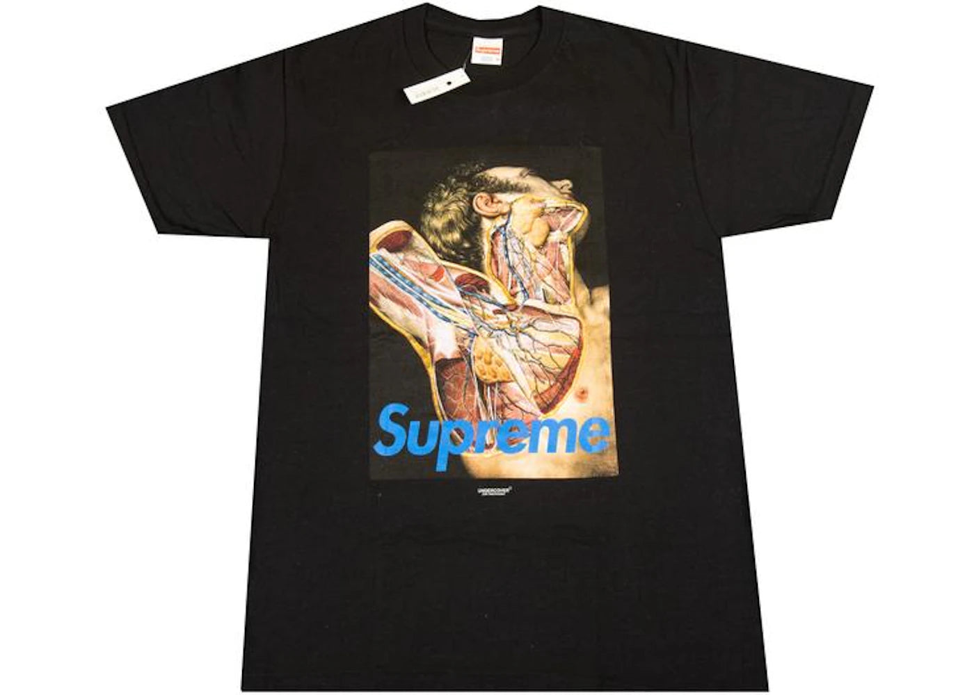 Supreme Undercover Anatomy Tee Black